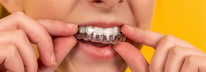 Orthodontist Portland ME Close-up of a Woman Putting In Her Invisalign Clear Aligner in Front of a Yellow Backdrop Close-up of a Woman Putting In Her Invisalign Clear Aligner in Front of a Yellow Backdrop