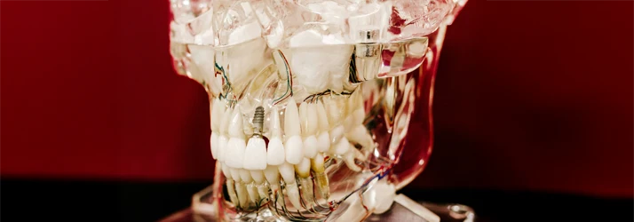 Orthodontist Portland ME Surgical See Through Model of a Jaw with Muscles Showing Teeth with Implants Surgical See Through Model of a Jaw with Muscles Showing Teeth with Implants